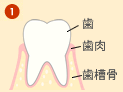 歯周病の進行 流れ1
